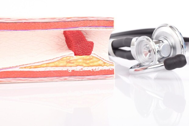 動脈硬化と糖尿病の関係