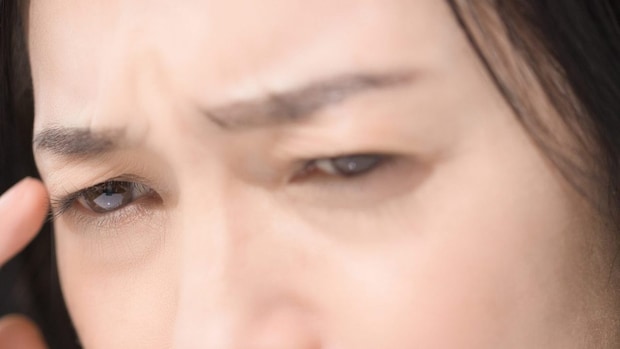 『表情じわ』に効果的なのは? ボトックスとヒアルロン酸の使い分けと違い