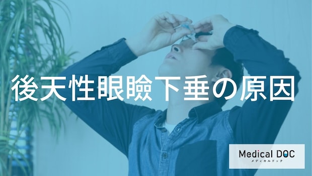 まぶたが下がる「眼瞼下垂」の原因とは?加齢以外に気をつけたいあの習慣を解説