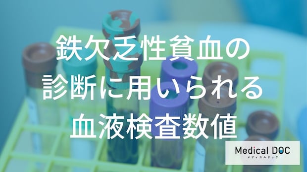 血液検査のどの値が低いと「貧血」と診断されるかご存知ですか？【医師監修】