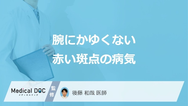 「腕にかゆくない赤い斑点」ができるとどんな「病気」が考えられる？医師が徹底解説！