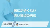 「腕にかゆくない赤い斑点」ができるとどんな「病気」が考えられる？医師が徹底解説！