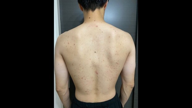 過信せず、「定期的な検診」と「生活習慣の見直し」を！