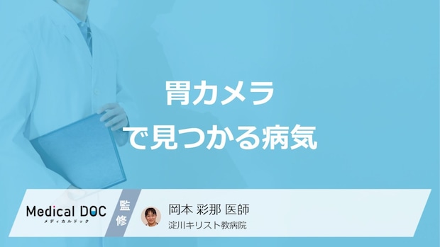 「胃カメラ」で発見できる”6つの病気”とは？見逃せない症状も医師が解説！