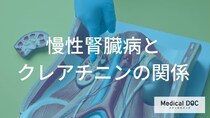「クレアチニン値」でわかる慢性腎臓病（CKD）のサインと進行度―治療方針決定の情報源にも