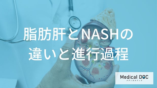 「脂肪肝」と「NASH」は何が違う？病態の進行過程と悪化を防ぐポイント【医師解説】