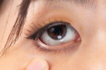 眼瞼下垂は自分で治すこともできる？眼瞼下垂を疑うべき症状・予防方法・放置するとどうなるかについても解説