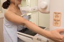 【乳がん検診】マンモグラフィと超音波（乳腺エコー）検査のどちらを受診すべき？