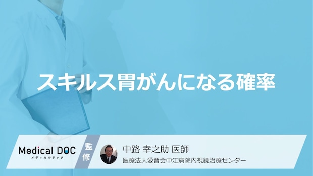 「スキルス胃がんになる確率が高い人」の4つの特徴はご存知ですか？【医師監修】