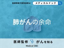 「肺がんの余命」と生存率についてご存じですか？ステージ別に解説！【医師監修】