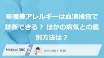 寒暖差アレルギーは血液検査で診断できる？ ほかの病気との鑑別方法は？