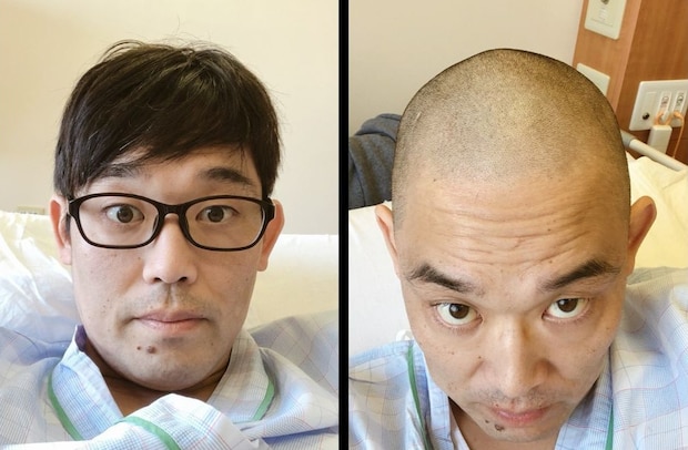 抗がん剤開始前散髪