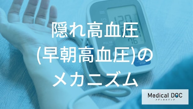 自覚症状がない『早朝高血圧』って何？ 朝の血圧測定が重要になる理由とは？
