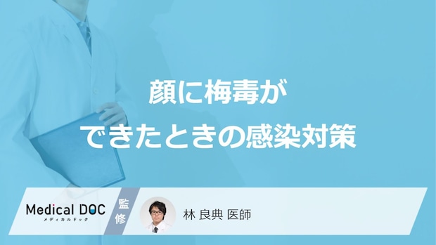 「顔の梅毒」が他者に感染することはあるの?【医師監修】
