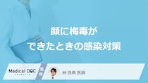 「顔の梅毒」が他者に感染することはあるの？【医師監修】