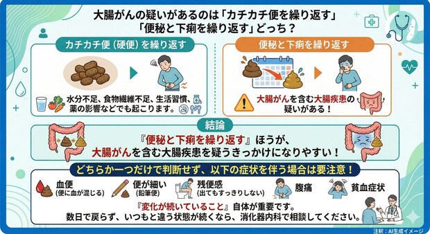 大腸がんの疑いがあるのは「カチカチ便を繰り返す」「便秘と下痢を繰り返す」どっち？
