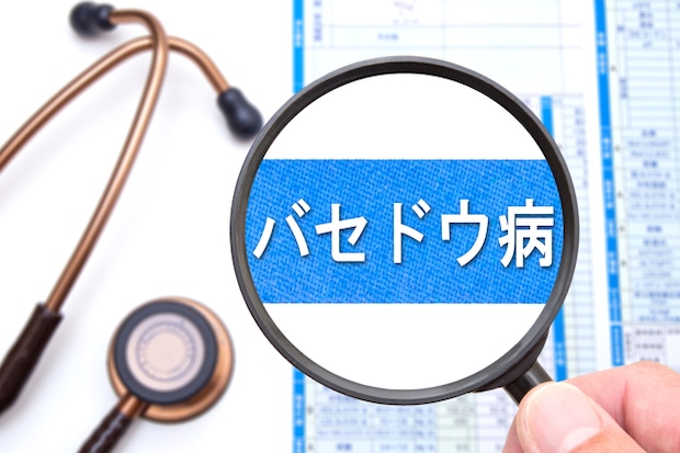 年齢のせいだと思っていた異変はバセドウ病が原因だった