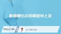 「動脈硬化」を発症すると「足にどんな初期症状」が現れるかご存知ですか？