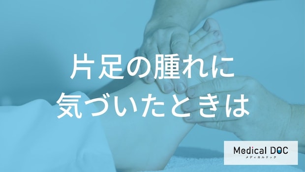 片足の腫れを放置しないで！「深部静脈血栓症」を防ぐための受診目安と確認事項を解説