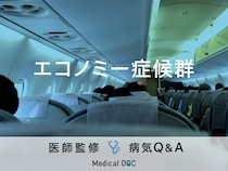 「エコノミークラス症候群」の前兆となる症状・発症しやすい人の特徴はご存知ですか？