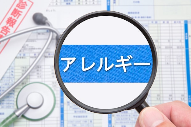 アレルギーの基礎知識