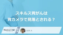 なぜ「スキルス胃がん」は”胃カメラで見落とし”されやすい？早期発見のコツも医師が解説！