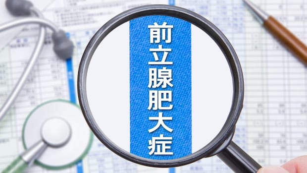 『前立腺肥大症』手術はどう選ぶ？ MISTやレーザーの違い【医師解説】