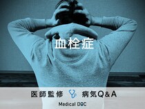 「血栓症」を発症すると現れる初期症状・原因はご存知ですか？医師が監修！
