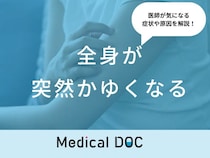 「全身が突然かゆくなる」原因・考えられる病気はご存知ですか？医師が徹底解説！