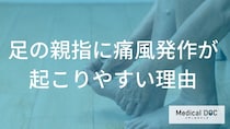あなたの”足の親指”は大丈夫？「痛風発作」が集中する3つの理由【医師監修】