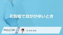 「花粉症で目がかゆい」ときの対処法はご存知ですか？目のかゆみの特徴も解説！