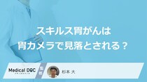 なぜ「スキルス胃がん」は”胃カメラで見落とし”されやすい？早期発見のコツも医師が解説！