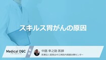 「スキルス胃がんの原因」はご存知ですか？【医師監修】
