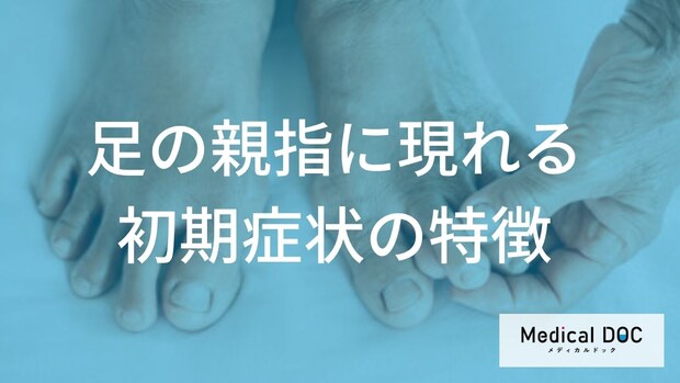 布団が触れるだけで激痛?足の親指に起きる「痛風発作」の初期症状【医師監修】
