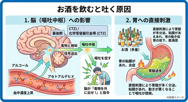お酒を飲むと吐く原因