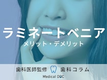 「ラミネートベニア」の寿命は? すぐに剥がれたりしない? 治療の流れやメリット・デメリットを歯科医が解説