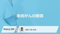 「皮膚がん」は何が原因だと”進行が早い”かご存知ですか？医師が解説！