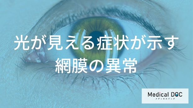 光視症のメカニズム 「網膜剥離」を未然に防ぐための「光」のチェック法とは?