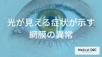光視症のメカニズム 「網膜剥離」を未然に防ぐための「光」のチェック法とは?