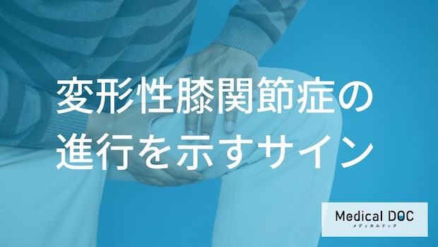 膝が曲がりにくいのは「骨のトゲ」が原因かも? 変形性膝関節症の進行を遅らせる日常生活の工夫