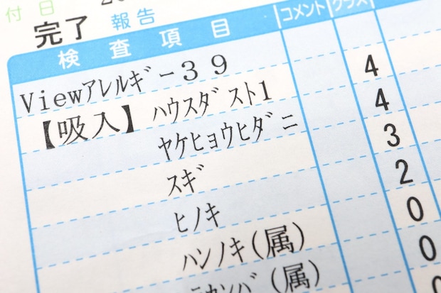 花粉症が起こる原因とは 子どもでも発症することはある？