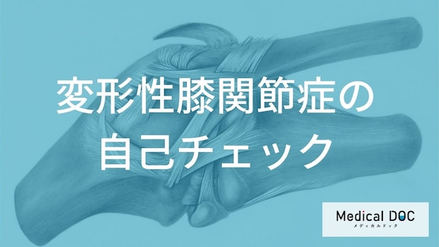 膝の痛みや腫れを放置していませんか? 変形性膝関節症の進行を防ぐ「自己チェック」のポイント
