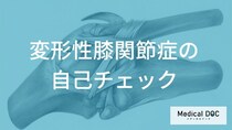 膝の痛みや腫れを放置していませんか？ 変形性膝関節症の進行を防ぐ「自己チェック」のポイント