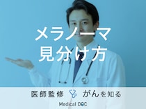 「メラノーマの見分け方」はご存知ですか？発症しないために気をつけることも解説！