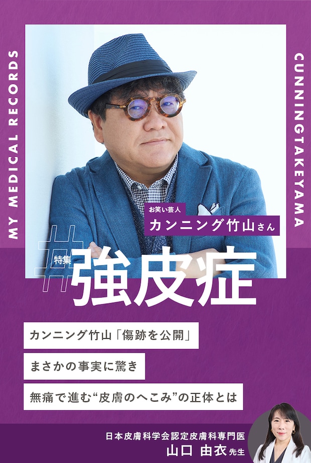 カンニング竹山「傷跡を公開」まさかの事実に驚き。無痛で進む“皮膚のへこみ”の正体とは