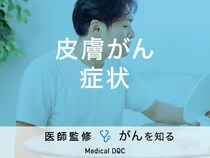 「皮膚がんの症状」はご存知ですか？検査・治療法も解説！【医師監修】