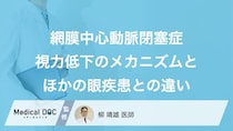 突然の視力低下はなぜ？ 『網膜中心動脈閉塞症』と他の眼疾患の違い【医師監修】