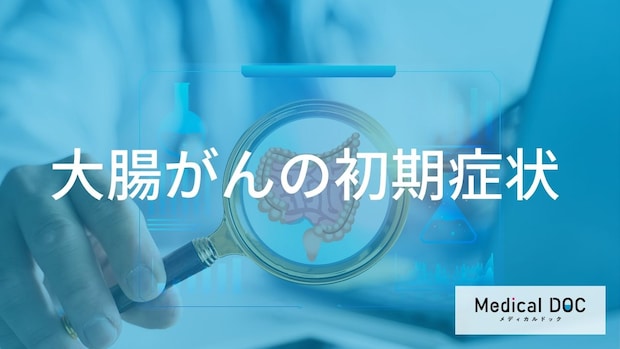 40歳以上は必見!初期の大腸がんは痛くない!無症状で進行する「2つの理由」と生存率90%