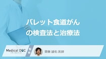 「バレット食道がん」の”検査にかかる時間”はどのくらい？3つの治療法も医師が解説！