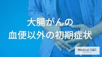 【新事実】血便だけじゃない！大腸がんの初期症状に潜む「下痢と便秘」の危険な繰り返し
